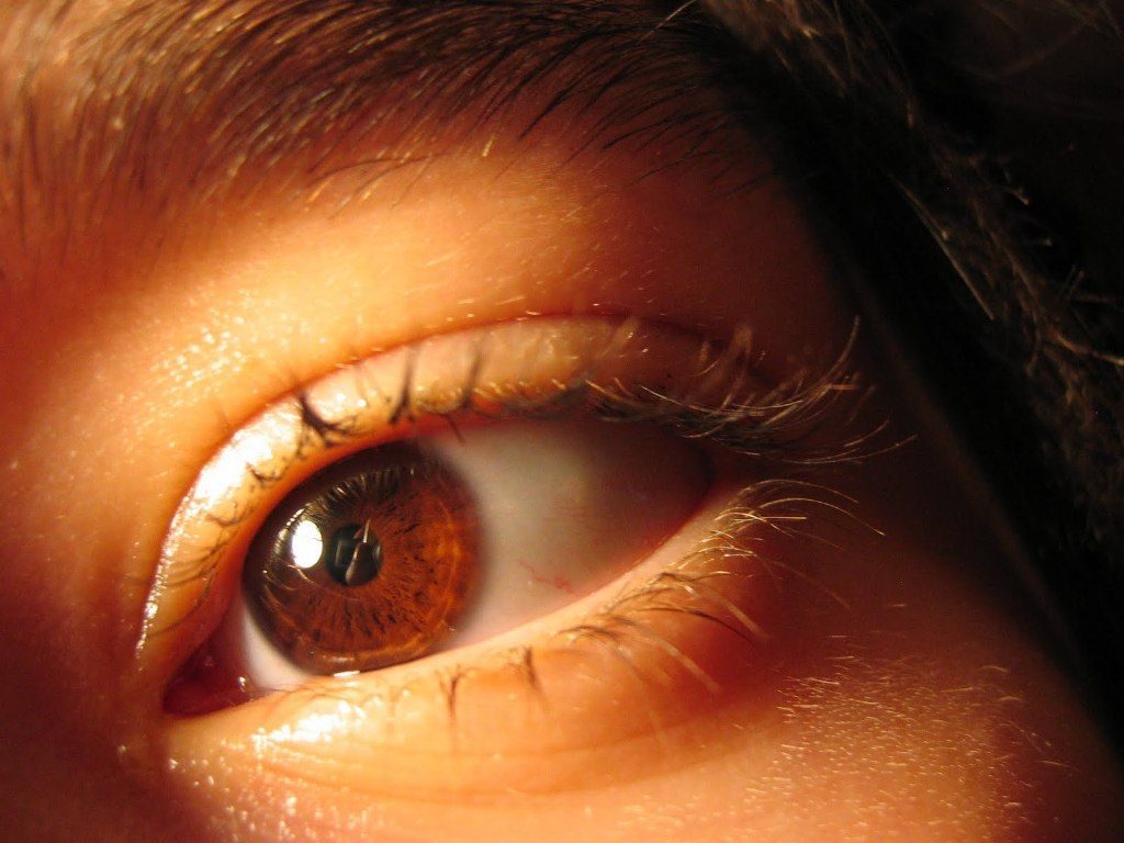 ¿Qué es el ojo diabético o retinopatía diabética?